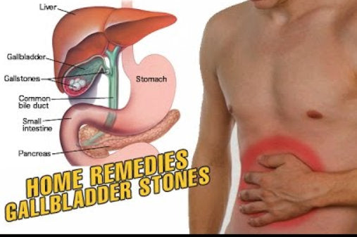 Did you know a gallbladder won’t grow back?